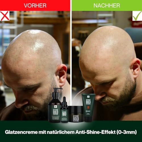 BETTER BE BOLD „Bestseller" Glatzenpflege-Routine (0-3mm) | Mattierende Glatzencreme (0-3mm) + Pflegendes Glatzenshampoo (0-6mm) + Invisible Sun Fluid LSF 50