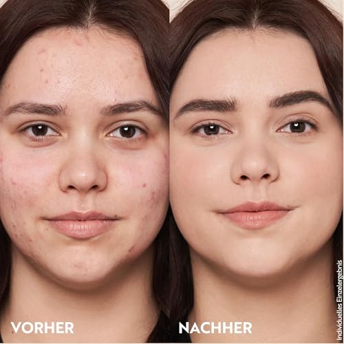 M. Asam Magic Finish Make Up Mousse Classic (30ml), 4-in-1 Primer, Make up, Puder & Concealer, Kaschiert, Gleicht aus, Verschönert & Perfektioniert - Für helle bis mittlere Haut, Vegan