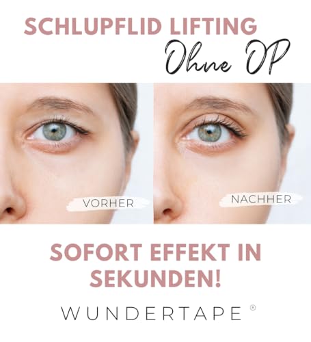 WUNDERTAPE Schlupflider Stripes unsichtbar Schlupflid-Tape Streifen zum Augenlid-Lifting ohne OP! (wasserfest, 24h Halt, double eyelid tapes) Augenlid-Tape (M + L + XL)